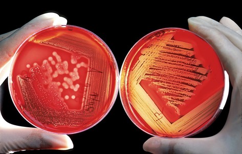 1000minds helps World Health Organization prioritize deadliest diseases